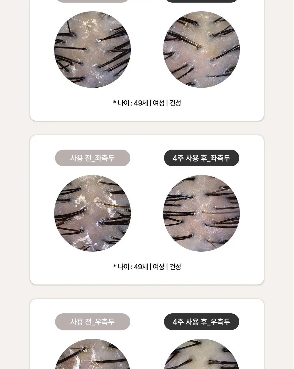 [비듬각질정화SET]라우쉬 콜츠푸트 안티-댄드러프 샴푸200ML&컨디셔너150ML 기획 상세페이지 8